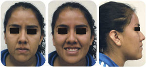 Facial photographs: frontal, smile and profile.