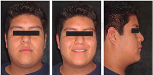 Pre-treatment facial photographs.