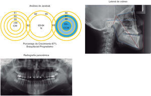 Análisis radiográfico de lateral de cráneo y panorámica.