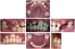 Intraoral photographs.