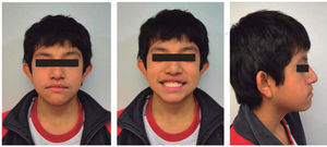 Initial facial photographs.