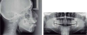 Iniciales: lateral de cráneo, panorámica, imágenes de tomografía computarizada de cone beam.