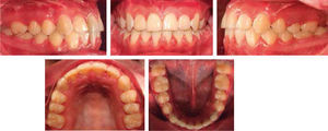 Final intraoral photographs.