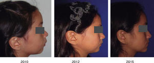 Fotografías comparativas de perfil.