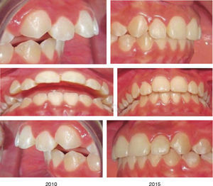 Comparative intraoral photographs.