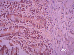 Positive control for immunohistochemistry of TGF-β3 in the small intestine (400x).