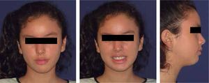 Facial photgraphs. Postural asymmetry is evident.