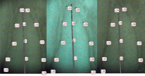 Distribution of the sites where the periodontal ligament was measured to perform the statistical analysis.
