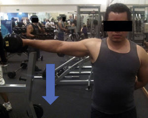 Eccentric contraction exercise for middle deltoids using dumbbells. Concentric movement involves shoulder abduction. Once it is abducted, slow eccentric contraction initiates by approaching the shoulder to the torso.