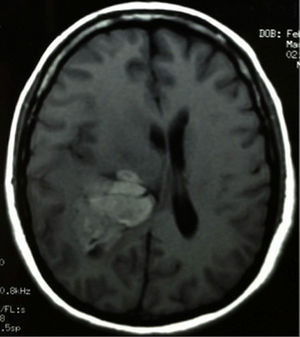 Simple axial T1 magnetic resonance image.