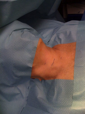 Positioning of the patient.