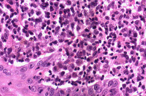 Haematoxilin–eosin stain×60 (violet intra and extracellular areas: Leishmania).