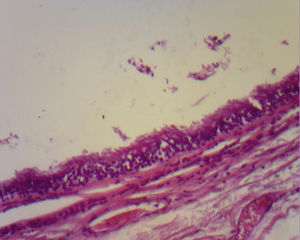 Respiratory epithelium which covers the inside of the cyst; mucous glands are noted. Haematoxylin–eosin staining.