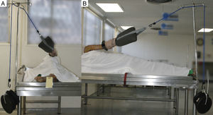 Positioning of the cadaver in order to perform the study. The posterior inclination of the upper limb at 30° can be observed and the application of traction to the upper limb. A. Anterior view. B. Inferior view.