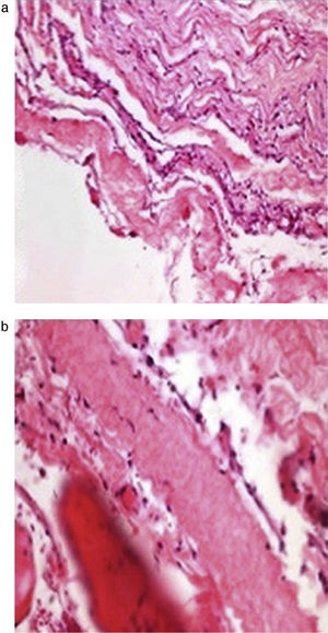Histopathological study with haematoxylin–eosin. (a) The slice is shown enlarged 20×. (b) The slice is shown enlarged 40×.