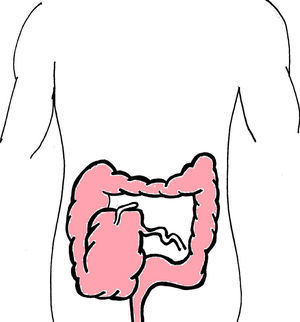 Diagram showing caecal bascule where a turning point upwards and in front of the ascending colon appears in the caecum, causing a valvular obstruction mechanism.