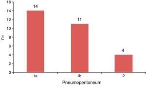 Localised pneumoperitoneum: modified Hinchey staging.