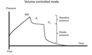 Pressure-time curve in the volume controlled mode. Resistive and elastic components of the lung are different. MIP corresponds to the maximal inspiratory pressure, P1 to a rapid drop in pressure after occlusion and Pp to the plateau pressure.