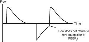 Flow-time curve, air entrapment. In the expiratory phase of the flow-time curve, it can be observed that the flow never reaches the abscissa axis. For this reason, the presence of intrinsic positive end-expiratory pressure (PEEPi) should be suspected.