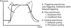 Pressure-time curve. Types of patient-ventilator asynchrony according to the time of the cycle when they occur.