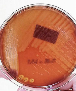 Abscess culture. Circular, translucent, of variable diameter and with smooth surface beta-hemolytic circular colonies are observed.