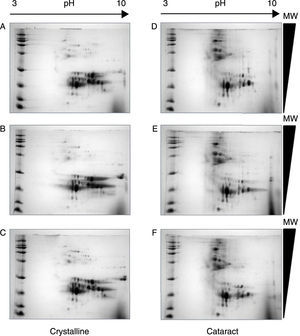 Quality and reproducibility of 2D electrophoresis from samples of both control crystalline and cataract lens of pediatric patients. A sample of normal crystalline (A, B, C) and cataract (D, E, F) lens were applied by triplicate to 2D-SDS-PAGE. Arrows represent the pH interval used for isoelectrofocusing interval, whereas right triangles indicate the molecular weight range of separation.