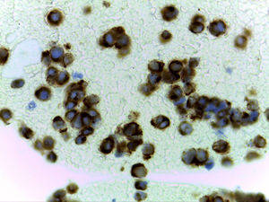 Histocytology image showing positive staining for CK20.