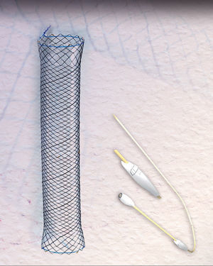 HANAROSTENT® Bariatric stent used in our study.