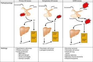 Different origins of GH oversecretion. Taken and modified from Rúa et al.21