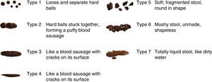 Bristol Scale for faeces assessment. Visual table with illustrations. Source: Lewis and Heaton.32