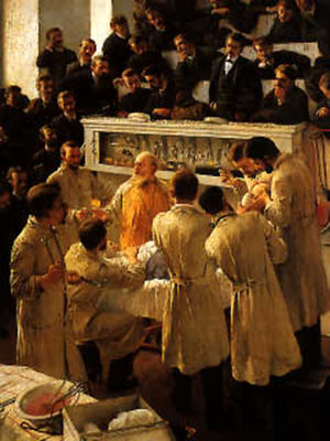 Theodor Billroth, father of modern abdominal surgery, operating at the General Hospital (Allgemeines Krankenhaus) of Vienna. Oil painting by Adalbert Seligmann painted in 1890. Österreichisches Galerie Belvedere (Vienna).