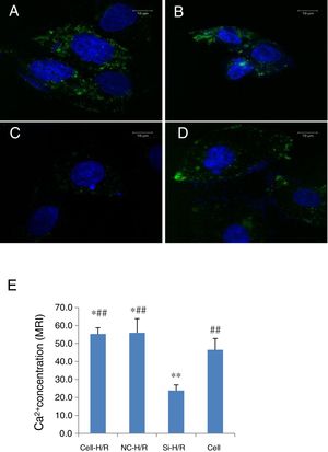 Transfection of frizzled-2 siRNA inhibited the H/R-induced intracellular Ca2+ concentration in BRL-3A cells. Fluorescence was shown in green color (528nm) to monitor the intracellular Ca2+ in BRL-3A cells with H/R treatment by Fluro 8-AM using confocal microscopy. (A) BRL-3A cells with H/R treatment (Cell-H/R); (B) H/R treatment of BRL-3A cells with transfection of negative control siRNA; (C) H/R treatment of BRL-3A cells with transfection of frizzled-2 siRNA; (D) control cells without H/R treatment; (E) bar graph showed the quantitative analysis of mean fluorescence intensity (MFI) of the intracellular Ca2+ concentration in different cell groups. Blue color denoted the nuclear stained with DAPI. Data were presented as means±SEM from three independent experiments. *p<0.05 and **p<0.001 when comparing to Cell group, and #p<0.05 and ##p<0.001 when comparing to Si-H/R group.