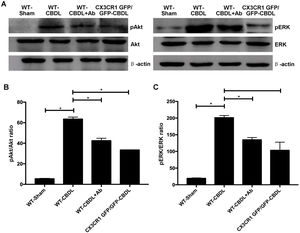 The effect of CX3CR1 blockade expression of molecules in Akt/ERK signaling pathway. A. Western blotting images for expressions of AKt, ERK, pAKt, and pERK in WT-Sham, WT-CBDL, WT-CBDL+Ab and CX3CR1GFP/GFP groups. B. Statistical analysis for the pAkt/Akt ratio. C. Statistical analysis for the pERK/ERK ratio. *P<0.05 represents the different value between two illustrated groups.