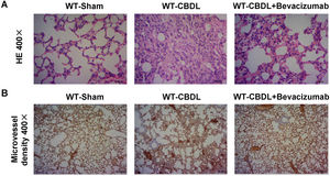 Effect of VEGF blockade by Bevacizumab on pathological changes of the lungs and angiogenesis. A. H&E staining of lung tissues at 400× magnification in WT-sham, WT-CBDL, and WT-CBDL+bevacizumab groups. B. Immunohistochemical staining for intrapulmonary angiogenesis using the CD31 antibody among the groups.