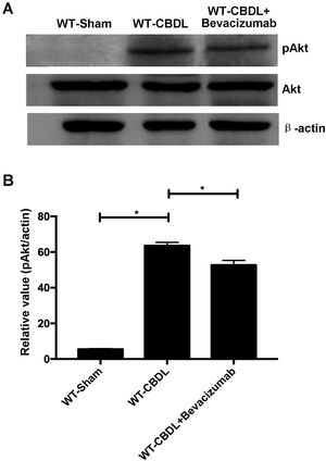Effect of VEGF blockade on expression of AKt, and pAKt in WT-Sham, WT-CBDL and WT-CBDL+bevacizumab group. A. Western blotting assay images. B. Statistical analysis for the expression of above molecules. *P<0.05 represents the different value between two illustrated groups.