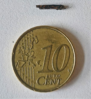 Surgical clip within the stone was identified.