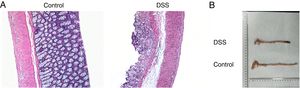 The pathological conditions and colonic length in the study groups. (A) The results from HE assays, goblet cell was arranged disorderly. The mucosa erosion and monocyte infiltration were observed in DSS induced groups. (B) The length of colon was shortened in DSS group (data are presented as mean±SD, ***p<0.001, n=3).