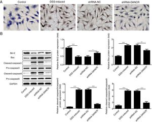 The effects of LncRNA-DANCR knockdown on cell apoptosis in the colitis stimulated by DSS. (A) The increased cell apoptosis was found in DSS induced group and shRNA-DANCR could reduce the cell apoptosis in DSS induced group. (B) Moreover, the anti-apoptosis protein, bcl-2 was decreased and pro-apoptosis proteins including Bax, cleaved-caspase 3 and cleaved-caspase 9 were up-regulated in DSS induced cells (data are presented as mean±SD, **p<0.01, ***p<0.001, n=3).