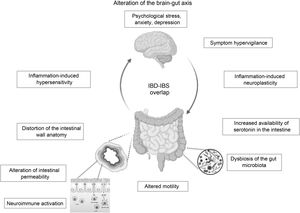 Mechanisms involved in the overlap between inflammatory bowel disease and irritable bowel syndrome.