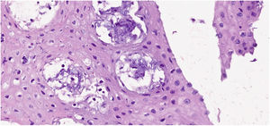 HE. 40×. Intraepidermal blisters with minimal inflammation.