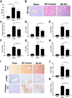 AH model was successful established in mice and depletion of NETs decreased liver injury, liver inflammation, fat deposition, and liver fibrosis in mice AH model. AH model was built in both WT and NE KO mice. Mice were euthanized at end of model building and liver or serum samples were collected. Serum ALT concentration was revealed by the ELISA method (A). The liver fat deposition was detected by Oil red staining (200×) and TG concentration detection (B and C). Liver mRNAs of lipogenesis-related genes (ACC1, FASN) expression was detected by qPCR (D and E). Intrahepatic inflammation was revealed by TNFα, CCL2, Cxcl1 with the qPCR method (F–H). Mice were tested for fibrillar collagen by Sirius red staining (200×) and expression of a-SMA and collagen 1a1 was determined by immunohistochemistry (400×) (I and J). Liver levels of fibrosis-related genes (ACTA-2, TIMP-2, and Collagen-1) were determined by qPCR(J and K).