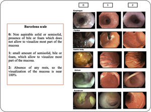 Sample Barcelona scale scores for each segment (esophagus, fundus, body, antrum, duodenum)
