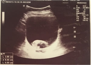 Ultrasound image of the kidney and urinary tract.