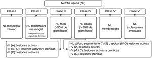 Classification of lupus nephritis.