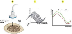 Radiofrequency Ecographic Multi Spectrometry (REMS) data: A) REMS analysis characterized by processing of unfiltered native signals from multiple scan lines; B) Spectrum derived from each scan line; C) Comparison with spectral patterns of healthy (green) and osteoporotic (red) subjects.