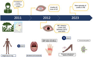 Timeline and key data from the anamnesis. LE: left eye; RE: right eye; MCP: metacarpophalangeal joints.