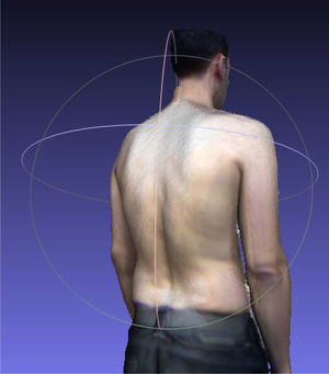 Example of a “Habitual standing posture” scan.
