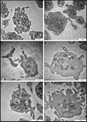 Representative transmission electron microscopy micrographs of EDTA-induced changes. (A) Activated platelets with significant morphologic changes in the cell membrane, including elongation of projections. (B) Large activated platelet in the center shows potential morphologic changes in the alpha granule bodies, which are preparing to condense and fuse with each other. (C) Extended platelet projections and initiation of PMP vesiculation. (D) Intact activated platelet with cell membrane fusion and PMP formation. Note the dense bodies, and projection of the cell membrane. (E) The cell membrane projections, and condensation of alpha organelles. (F) Platelet in the advanced stage of activation, in which the cell membrane is damaged. PMPs, and other cell organelles, such as dense bodies, and alpha granules, are released.