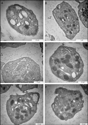 Representative transmission electron microscopy micrographs of citrate-induced changes. (A) Cross-sectional plane of normal platelet shows smooth regular cell membrane. The open canalicular system, and alpha granules are shown. (B) A platelet cut through the longitudinal plane shows the structure containing alpha granules, and open canalicular system. (C) Normal platelet cut through the cross-sectional plane. The open canalicular system, mitochondria, and alpha granules are shown. (D) Normal platelet reveals intact cell membrane and some cell organelles. The platelet structure shows alpha granules, dense bodies, and filaments extended dense bodies. (E) Normal platelet with glycogen deposit. (F) Platelet in the early stage of activation, as indicated by cell membrane changes.