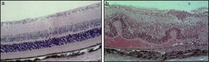 Murine retinal histology sections showing cross-sections of: (a) normal mouse retina and (b) EAU mouse model retina.